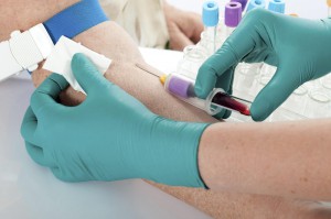 esame del sangue